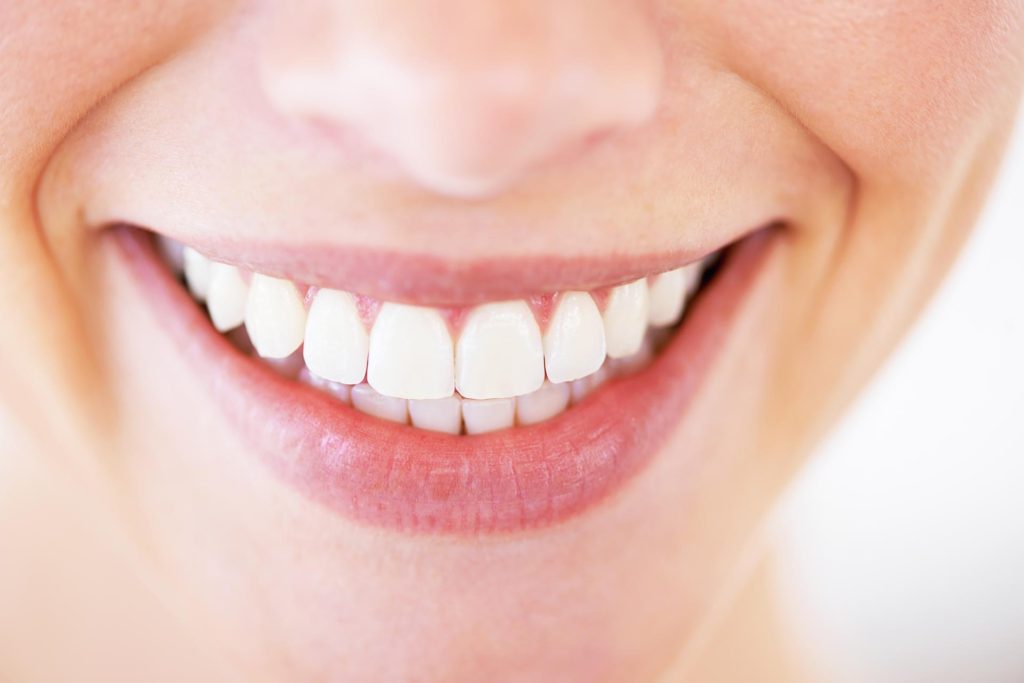 Gingivectomy & Gingivoplasty Dental Treatment in Turkey - Antalya Dent Smile