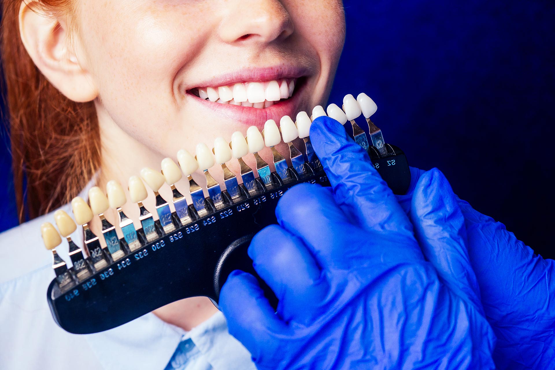 Crowns x Veneers What Is the Difference? Antalya Dent Smile