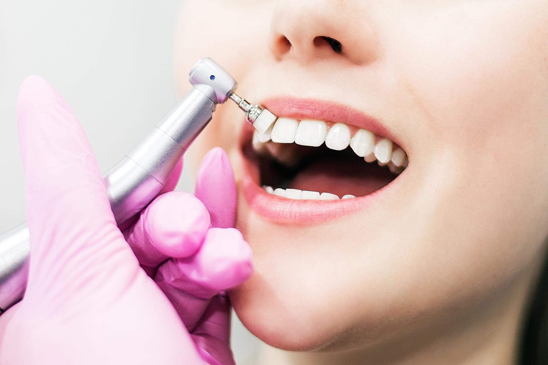 Porque Devemos Preocupar-nos Com a Placa Bacteriana?, image size:1920x1281