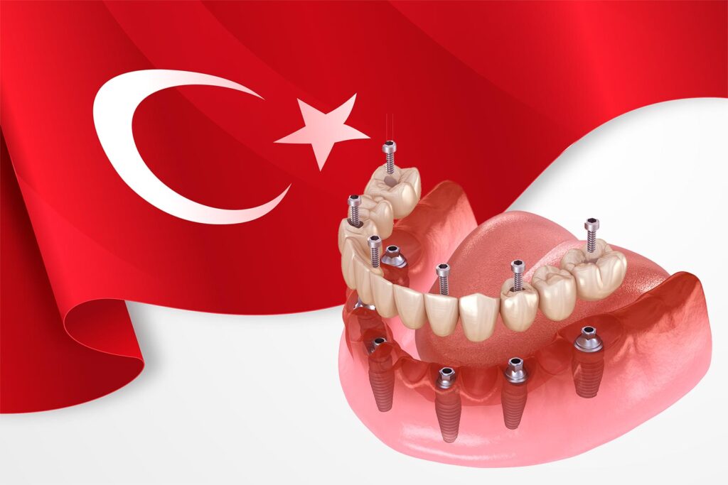 Porque é que as pessoas preferem a Turquia para tratamentos dentários?