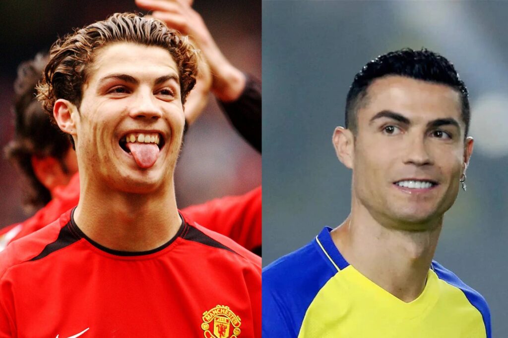Are Cristiano Ronaldo's Teeth Porcelain Veneers? - Antalya Dent Smile