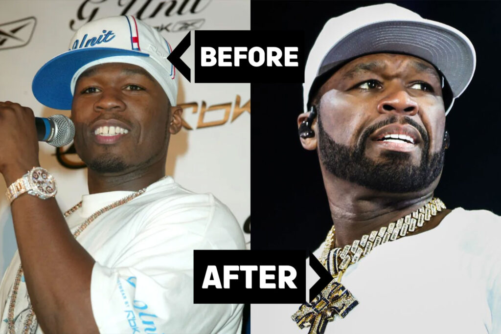 Welcome to the Smile Shop with 50 Cent’s Sweetest Transformation